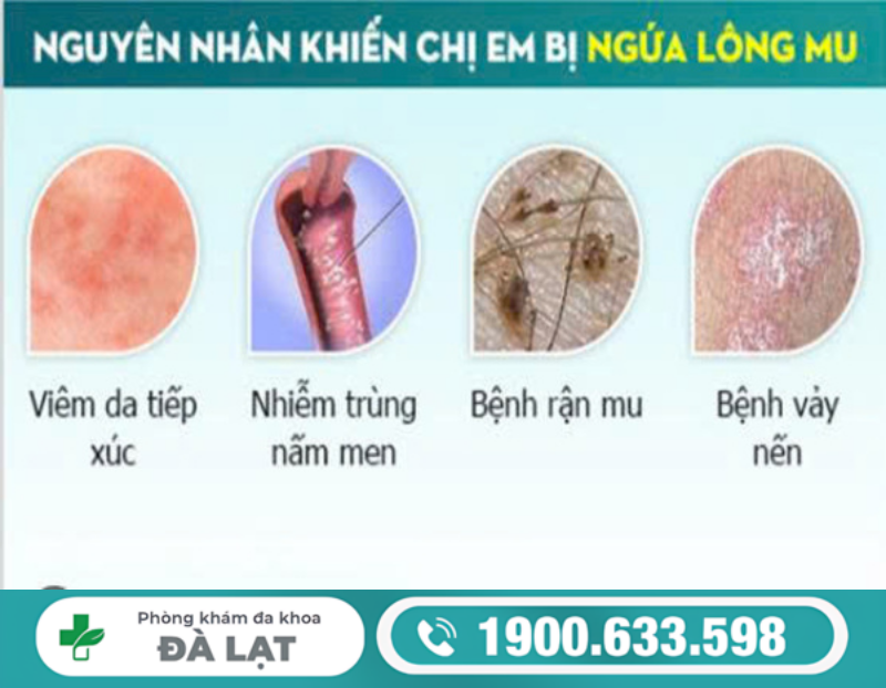 Hình ảnh minh họa